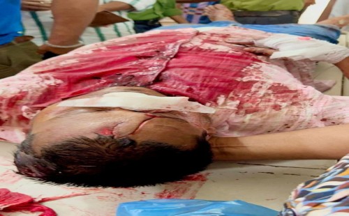 কালিয়াকৈরে ঝুট ব্যবসা নিয়ে বিএনপির দুই গ্রুপে সংঘর্ষ, আহত ১০